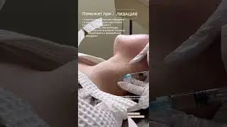 💦Мезотерапия и Биоревитализация для Вас❕ #мезотерапия #красота #биоревитализация  #beauty