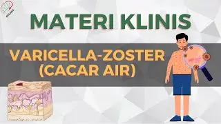 Varicella-zoster (cacar air) | Dermatologi