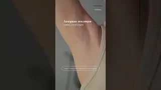 Избавим от раздражения и вросших волос! #косметологиямосква#клиникакосметологии