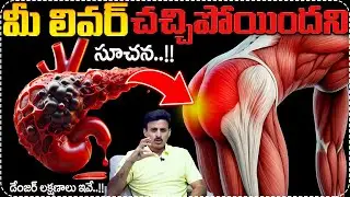 ⚠️LIVER is DYING! Dr. Ravikanth Causes of Liver Failure | Most Common Cause Alcohol | SumanTV Deepti