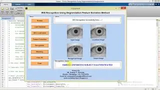 Iris Recognition Using Segmentation Feature Extraction Matlab Project with Source Code