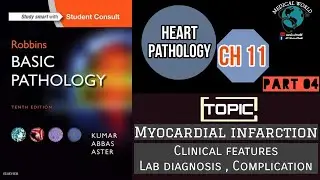 Myocardial infarction P4 | Clinical features | Lab diagnosis Complications | Robbins Heart Attack