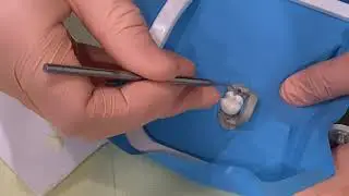 4   BASE DE IONOMERO DE VIDRIO