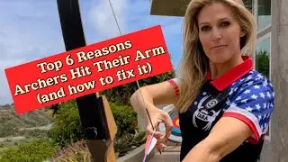 Archery: Why Archers Hit Their Arm and How To Fix It