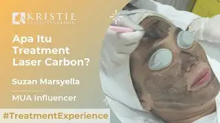 #treatmentexperience Carbon & Eye Bag Laser, Revit Glow Infusion I Suzan Marsyella (MUA Influencer)