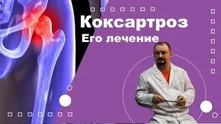 Коксартроз. Лечение коксартроза.