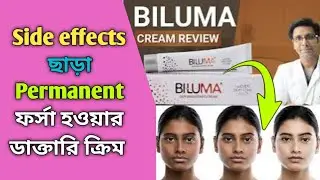 Biluma Cream Use | Biluma skin lightening cream review | ফর্সা হওয়ার ডাক্তারি ক্রিম