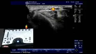 NextGen LOGIQ e: Color Flow Controls