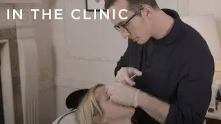 How to do Subtle Botox and Fillers in Late 30s