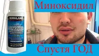 Что Случилось С моей БОРОДОЙ спустя ГОД!?!