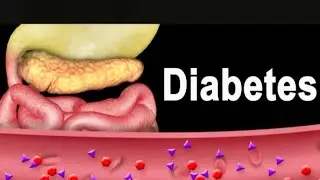 Descontrolada