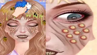 ASMR Worm & Maggot face Infected |Deep Cleaning Animation