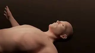 Portable Choking Rescue Device