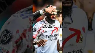 Antonio Rüdiger Evolution 😳🥶 