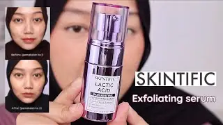 Review & Cara Pakai Exfoliating Serum SKINTIFIC Lactic Acid Skin Renewal
