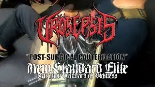 UROSEPSIS - 
