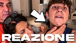 I miei GENITORI Reagiscono al mio INCIDENTE!