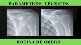 Shoulder Routine - Which Radiograph Looks Better: (Corrected AP vs. Uncorrected AP)?