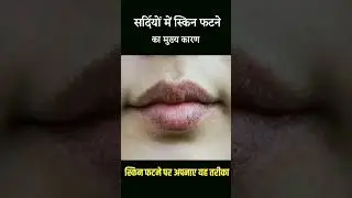 dry skin mein kya lagaye | sardiyon mein chehre par kya lagaye | #shorts