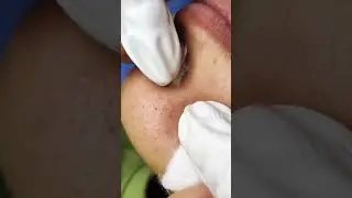 Best Satifying videos for Relaxation with Rat Tana Acne Spa =Short