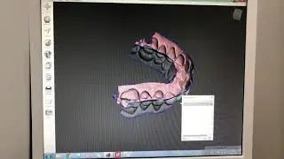 converting a CEREC scan to 3D Print