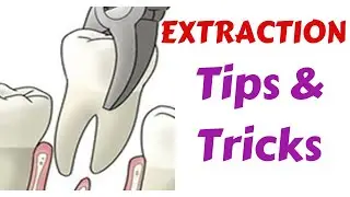 Exodontia Tips & Tricks - Diagnosis & Treatment Panning || Indication, Medical & Dental Evaluation