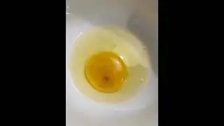 Это бьющееся сердце❤️