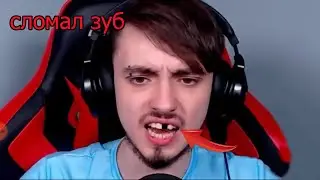 эдисон сломал зуб (нарезка со стрима )