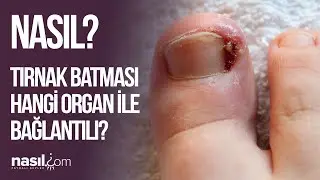 TIRNAK BATMASI BU HASTALIKLARIN HABERCİSİ OLABİLİR! 