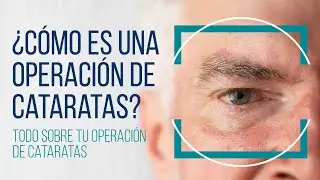 Todo sobre tu operación de cataratas #cataratas  #cirugiadecataratas