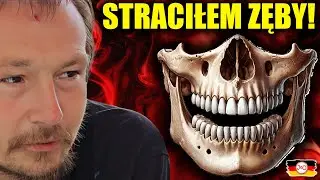 W ciągu MIESIĄCA STRACIŁEM ZĘBY