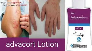 advacort lotion, advacort lotion  uses, advacort lotion  in urdu, advacort lotion complete review