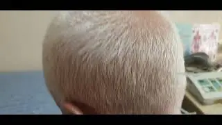Шум в ухе. Индивидуальные точки.