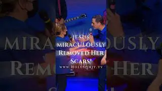 Jesus miraculously removes scars! www.HolySpirit.tv #shorts ישוע מסיר צלקות באורח פלא!