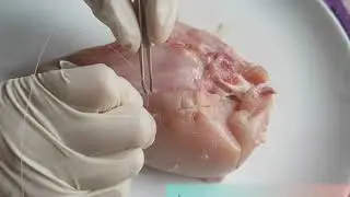Cara menjahit luka perineum