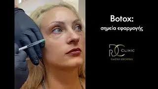 BOTOX σε ποιές περιοχές λειτουργεί καλύτερα