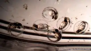 Zebra Danio Fish Eggs Hatching under a Microscope Water Bacteria Swimming