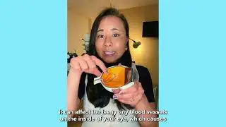 Ask An Eye Doc: Heart Disease And Your Eyes