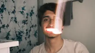 new smile