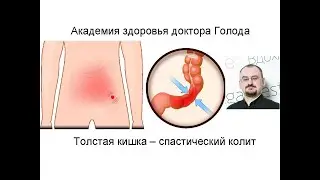 Толстая кишка. Спастический колит.