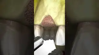Не Теряй Зубы! 
