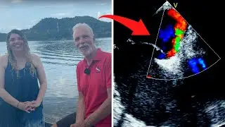 Foramen Oval Permeable Y El Buceo con la Dra. Paulina
