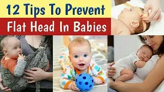 12 Tips To Prevent Flat Head Syndrome In Babies | Plagiocephaly Prevention & Treatment