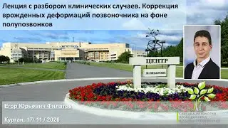Pазбор клинических случаев. Коррекция врожденных деформаций позвоночника на фоне полупозвонков