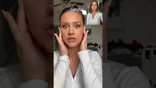 How to do a face lift at home without surgery