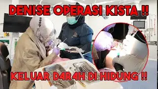 DENISE CYST REMOVAL SURGERY!!
