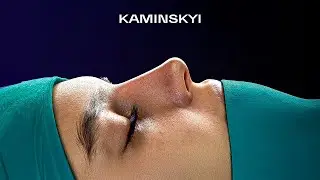 The beauty of the rhinoplasty / KAMINSKYI
