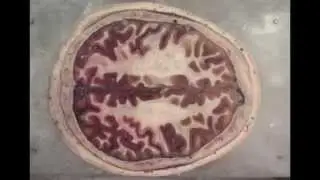 Inside the Brain: An Entire Head in Cross-Section