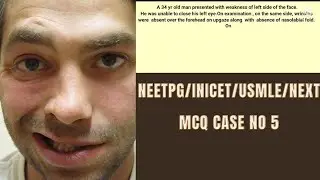 NEETpg/Next/usmle/inicet - MCQ on Facial nerve palsy