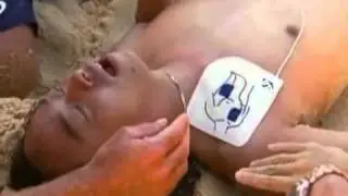 Agonal Gasps - Bondi Beach Rescue